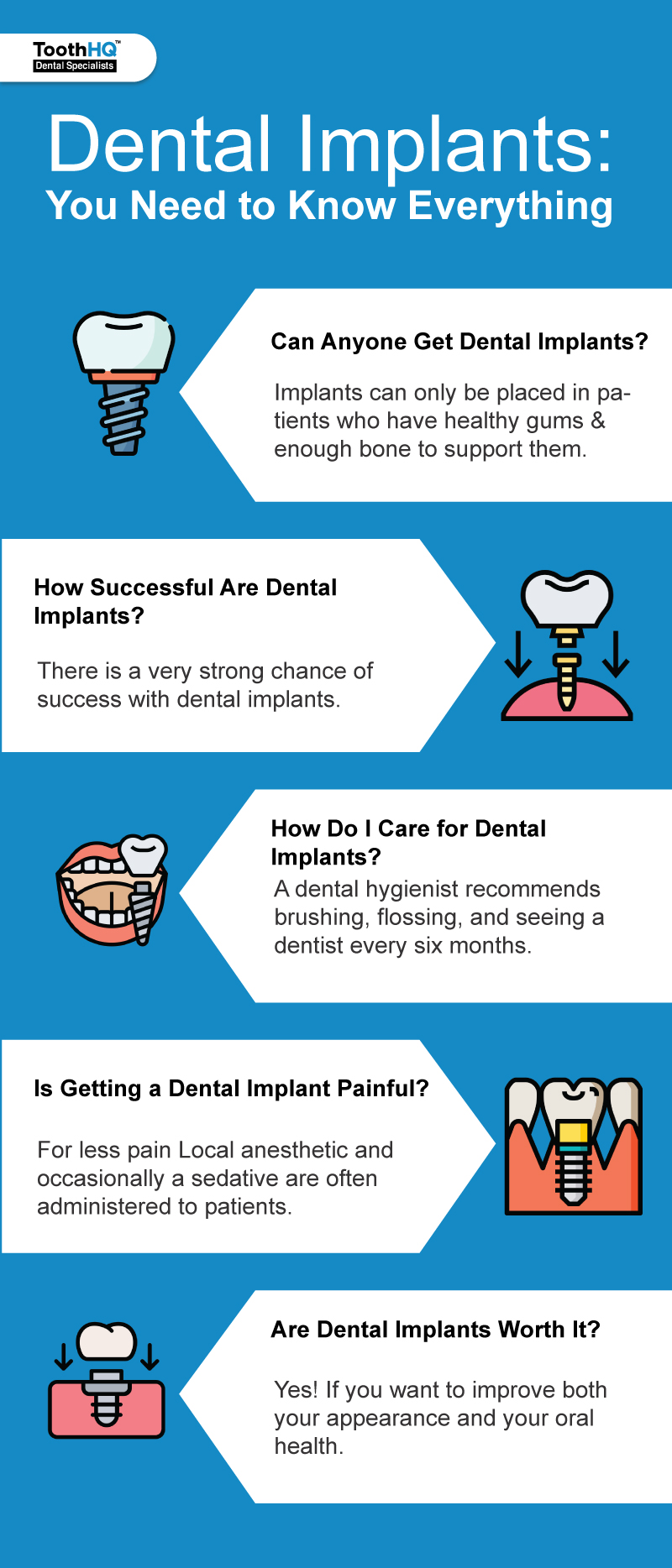 How do we define Dental Implants?