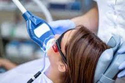 What is Laser Dentistry? | Houston Laser Dentistry | Laser Teeth Whitening
