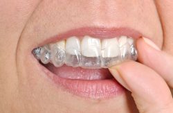 Are Invisible Braces The Same as Invisalign |General dentistry