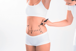 Liposuction contour irregularity massage