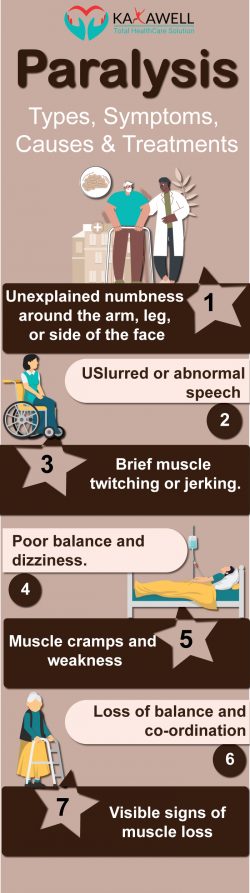 Paralysis: Symptoms, Causes & Treatments