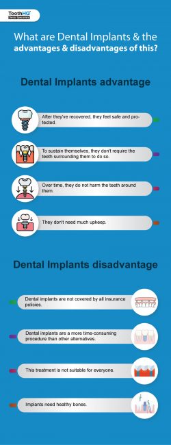 What are the dental implant advantages?