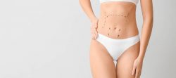 What Is Involved in Tummy Tuck Surgery?