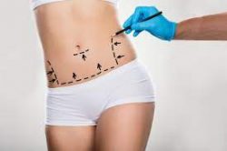How long does abdominoplasty surgery take?