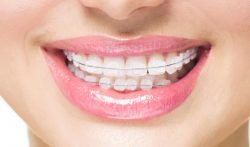 Tooth Pain After Dental Work | Impacted Wisdom Teeth