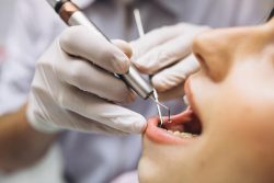 Pediatric Dentist in Miami FL | Pediatric Dentist