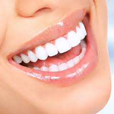Professional Teeth Whitening Dentist Near Me | Teeth Whitening Houston