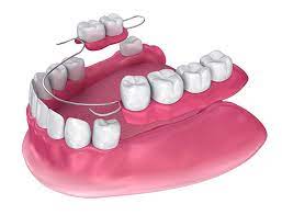 Affordable Partial Dentures Near Me