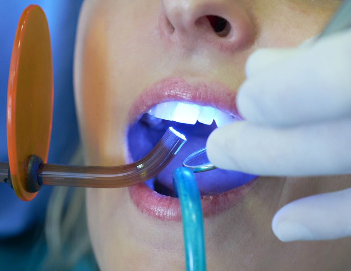 TMJ Treatment Houston TX | TMJ Treatment Near Me – Edge Dental