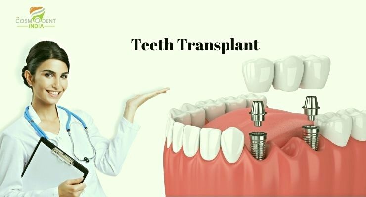 Cost of Permanent Teeth Transplant in India