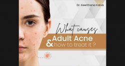 Best Acne Treatment in Hyderabad | Dr. Keerthana Kalva
