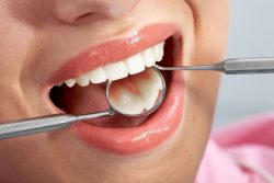 Orthodontist Specialist Of Florida | Teeth Bite Occlusion