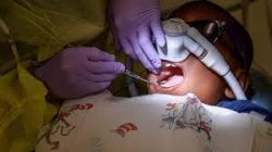 Factors to Consider When Choosing a Dental Care Center | URBN Dental