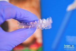 How Invisalign Bite Ramps Improve Your Orthodontic Health? | Different Braces
