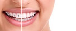 What is an Orthodontist? | Want to be an orthodontist in Miami