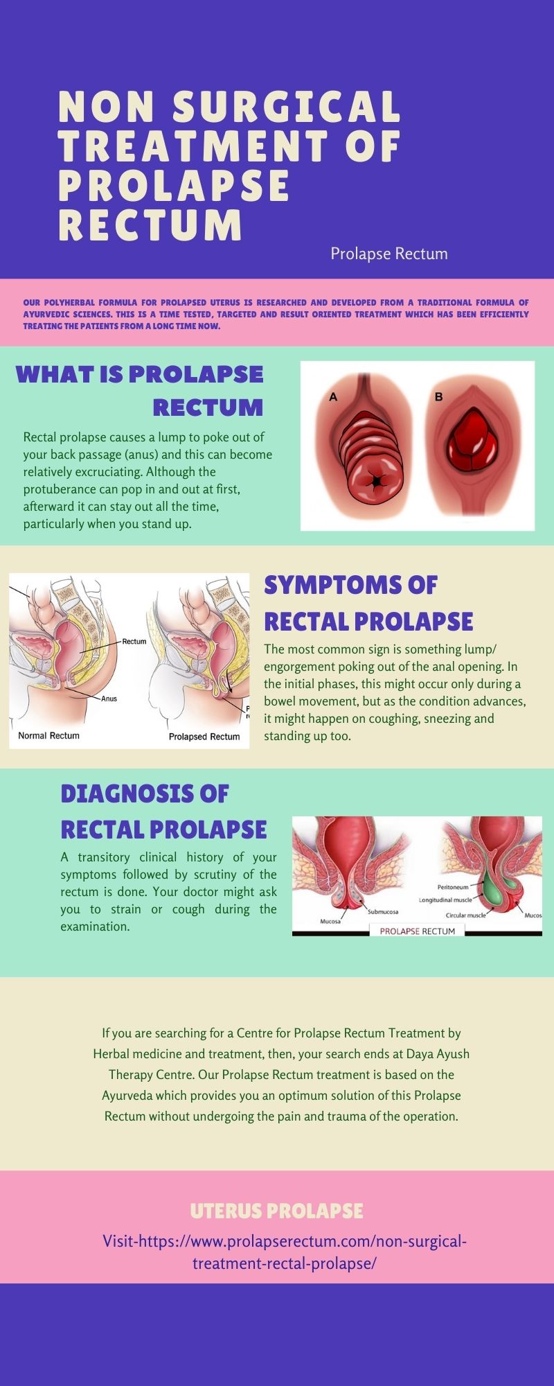 Non-Surgical Treatment Of Prolapse Rectum