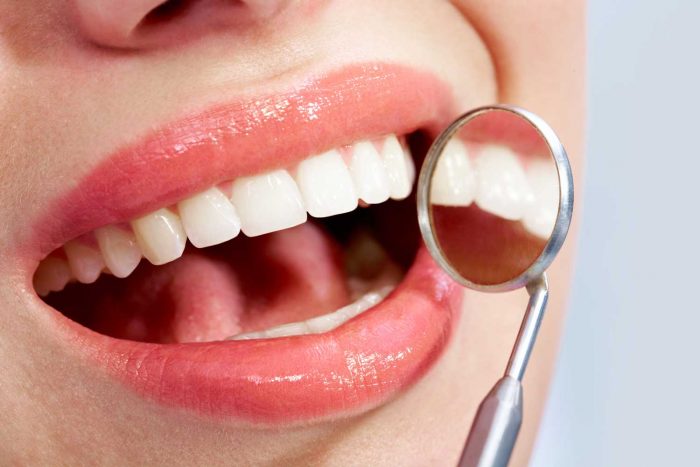 Dental Fillings & Root Canal Treatment | Doctor Montrose | URBN Dental