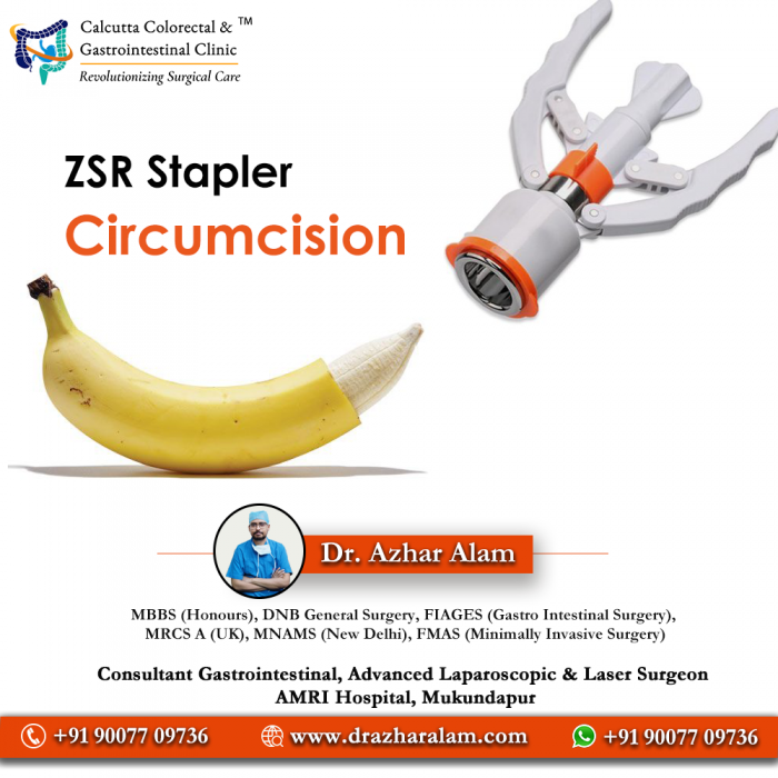 Circumcision Doctor in Kolkata | Laser Circumcision Surgery