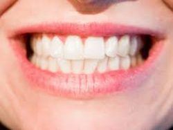 How Dental Cleaning and Polishing Work | Teeth Polishing: Benefits, Cost