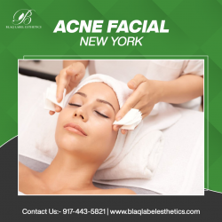 acne Facial in New York