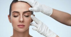 What is Blepharoplasty Surgery?