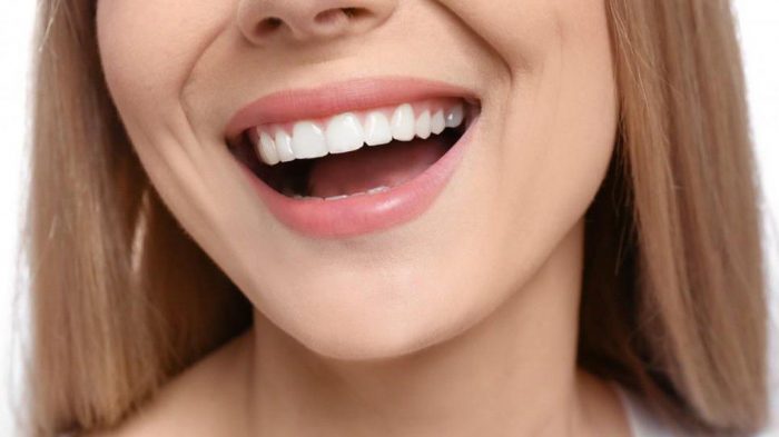 How to Get Rid of Stains on Teeth | Porcelain Laminate Veneers