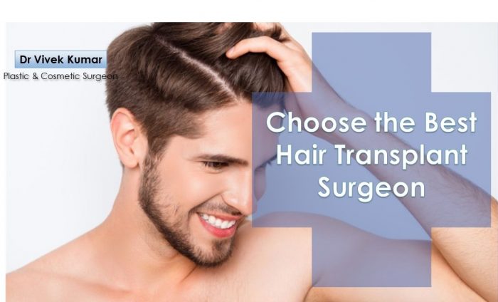 Tips Before Choosing the Best Hair Transplant Surgeon in Delhi – Dr. Vivek Kumar