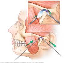 Temporomandibular Joint Disorder  | TMJ/TMD Treatment & Symptoms