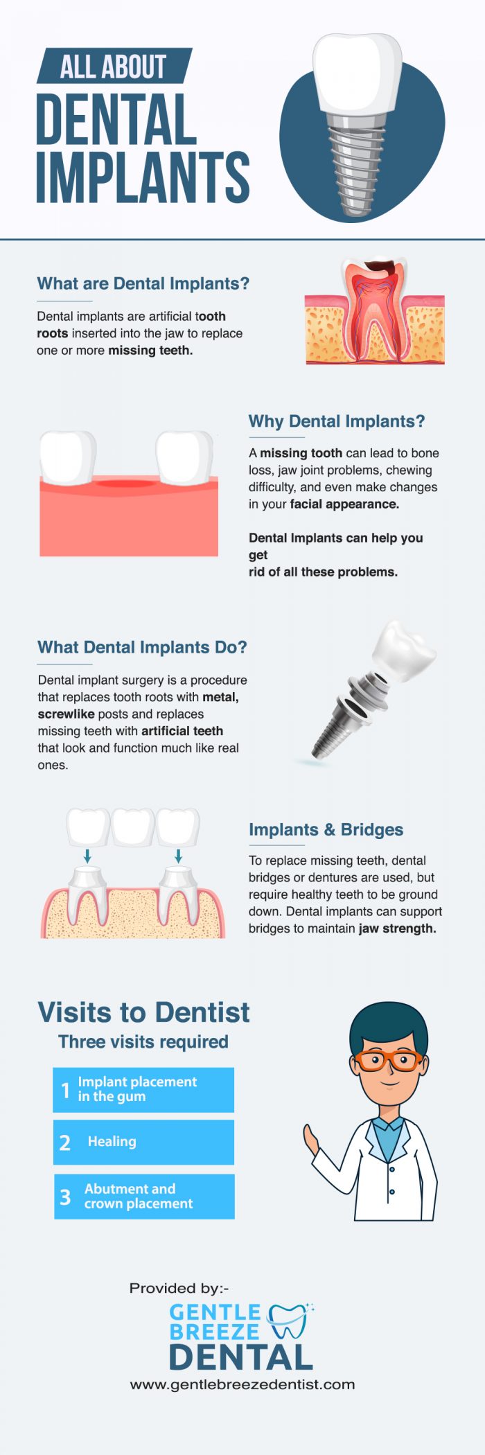 Restore Your Smiles With Dental Implants In Port St Lucie, FL at Gentle Breeze Dental