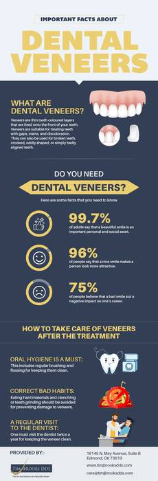 Get Quality Dental Veneers In Edmond, OK From Tim J Brooks DDS