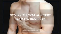 Gynecomastia surgery and its benefits – Dr. Vivek Kumar