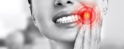 Wisdom Teeth Removal Houston TX | Wisdom Tooth Extraction Near Me – Sapphire Smiles