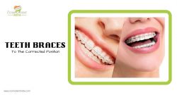 Invisible Teeth Braces Cost in India