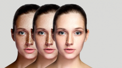 Laser Beauty Skin Center NY | Laser Skin Rejuvenation NY | Laser Skin Services NY – Bared  ...