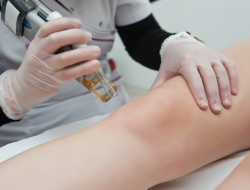 Laser Hair Removal – Get Services from 360 Degree Clinic
