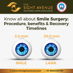 Relex Smile Eye Surgery – Relex Smile Surgery