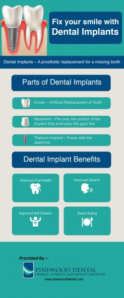 Replace Your Missing Teeth With Dental Implants In Lemont, IL From Pinewood Dental
