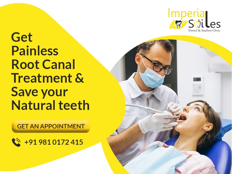 Get Painless Root Canal Treatment in Gurgaon at Imperial Smiles Dental and Implant Clinic