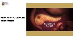 Surgery For Pancreatic Cancer By Dr Ganesh Nagarajan