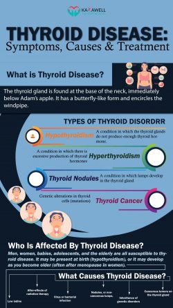 Thyroid Disease: Symptoms, Causes & Treatment