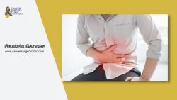 Treatments Of Gastric Cancer By Dr. Ganesh Nagarajan