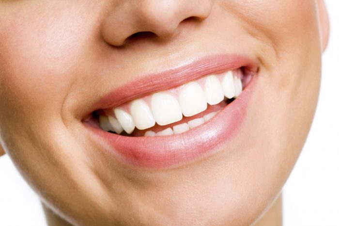 Straight White Teeth | How To Get Straight Teeth