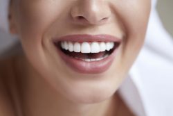 The Best 10 Teeth Whitening in Houston, TX | Home Teeth Whitening