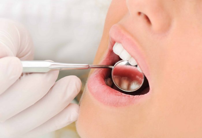 Emergency Dental Extraction Procedure | Dental Extraction Aftercare