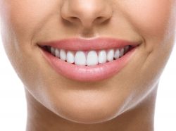 How much do veneers cost?