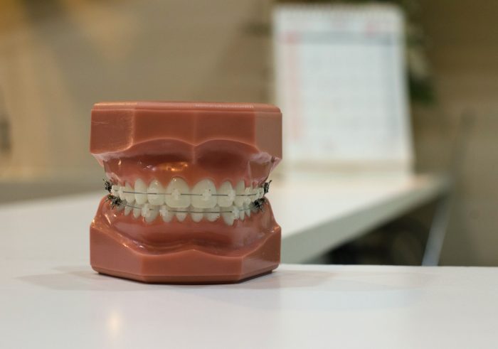 It is Time to Find Affordable Invisalign Braces Near Me