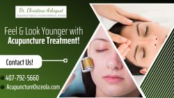 Anti-Aging Acupuncture Treatment near St. Cloud