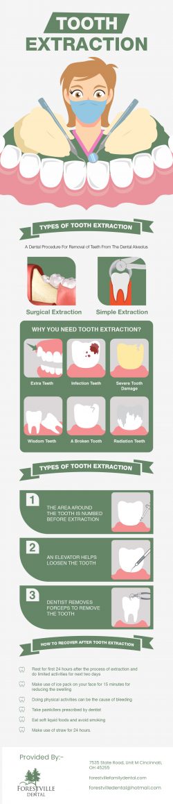 Choose Forestville Dental For Tooth Extraction In Cincinnati, OH