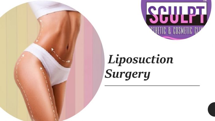 Solutions for Big Belly Fat | Get Your Liposuction Surgery in India – Dr. Vivek Kumar