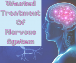 Wanted Treatment Of Nervous System